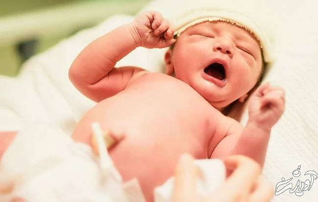 تاخیر در بستن بند ناف بستن بند ناف